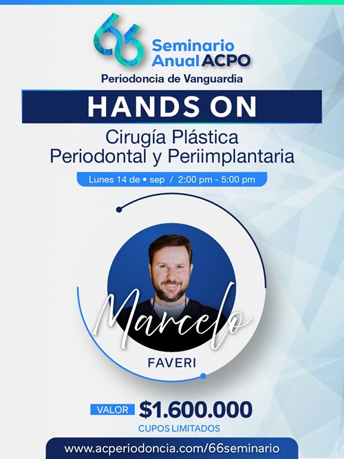Hands On Marcelo Faveri